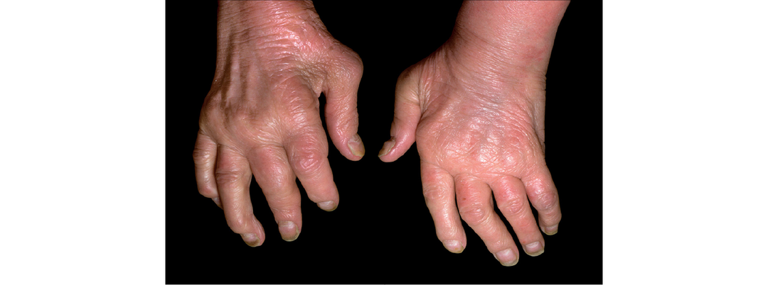 Нутра оффер с которого может начать каждый новичок