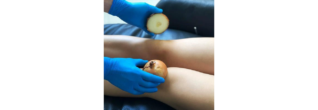 Нутра оффер с которого может начать каждый новичок